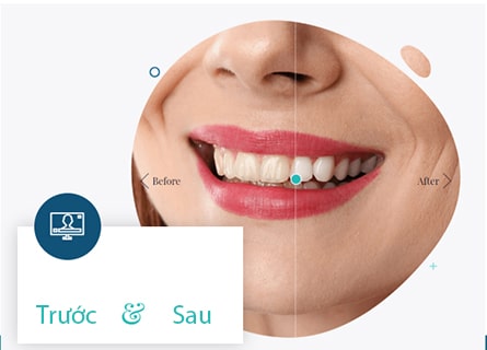 Thiết kế website Nha Khoa - Răng miệng